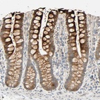Immunohistochemical staining of human small intestine shows high expression.