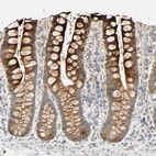 Anti-ACSL5 Antibody