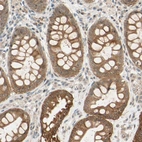 Immunohistochemical staining of human rectum shows moderate cytoplasmic granular positivity in glandular cells.