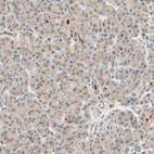 Anti-ACSL5 Antibody