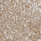 Immunohistochemical staining of human liver shows moderate cytoplasmic granular positivity in hepatocytes.