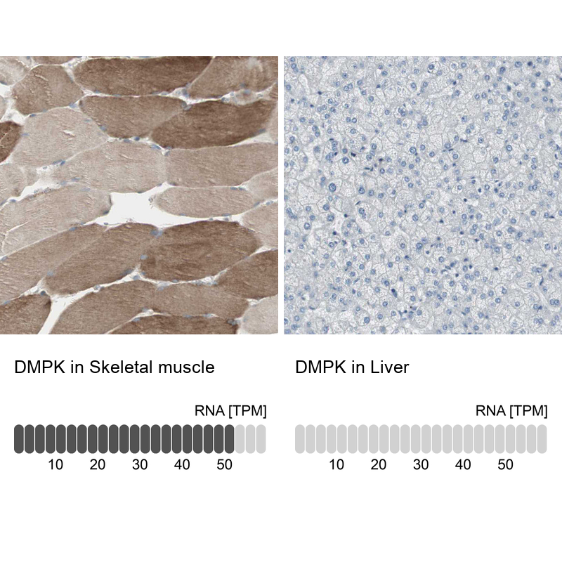 Anti-DMPK Antibody