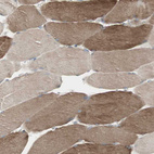 Immunohistochemical staining of human skeletal muscle shows strong cytoplasmic positivity in myocytes.