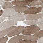 Immunohistochemical staining of human skeletal muscle shows strong cytoplasmic positivity in myocytes.