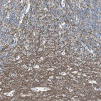 Immunohistochemical staining of human cerebellum shows strong positivity in neuronal processes.