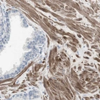 Immunohistochemical staining of human prostate shows strong cytoplasmic positivity in smooth muscle cells.