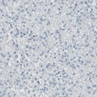 Immunohistochemical staining of human liver shows no positivity in hepatocytes as expected.