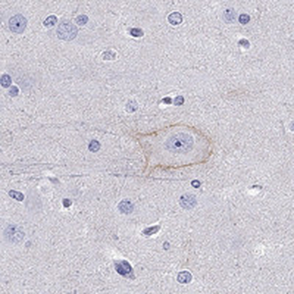 Anti-CDH9 Antibody