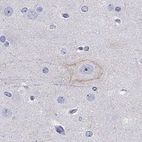 Anti-CDH9 Antibody