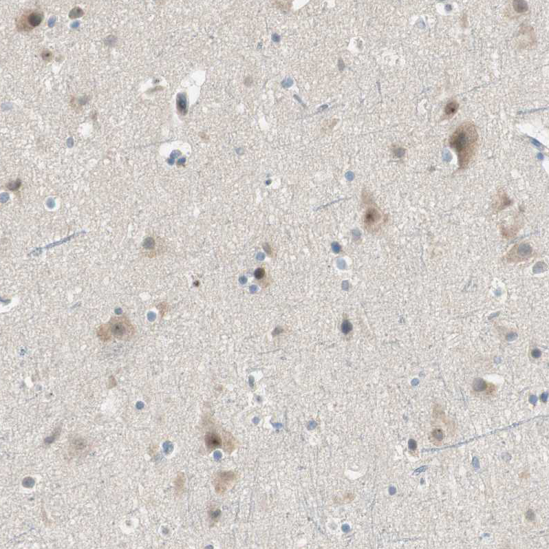 Anti-PCDHB15 Antibody