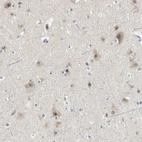 Anti-PCDHB15 Antibody