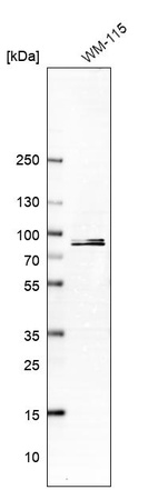 Western blot analysis in human cell line WM-115.