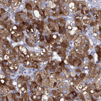 Anti-PTPRN Antibody