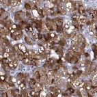 Immunohistochemical staining of human adrenal gland shows strong cytoplasmic positivity in medullary cells.