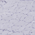 Immunohistochemical staining of human skeletal muscle shows low expression as expected.