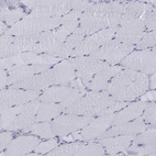 Immunohistochemical staining of human skeletal muscle shows low expression as expected.