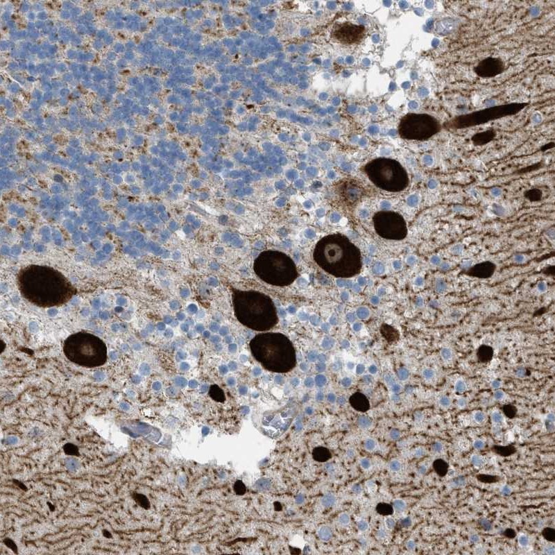 Anti-ATP2A3 Antibody