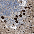 Anti-ATP2A3 Antibody