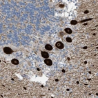 Anti-ATP2A3 Antibody