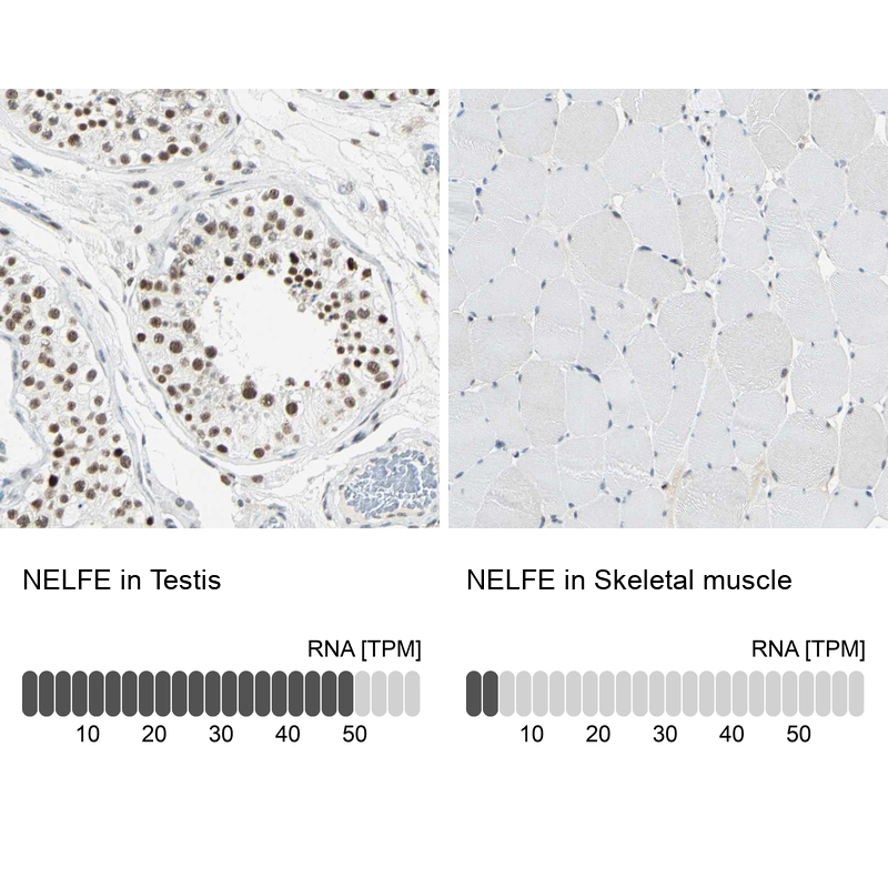 Anti-NELFE Antibody