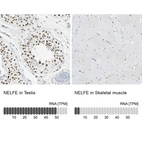 Anti-NELFE Antibody