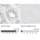 Anti-NELFE Antibody