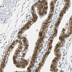 Anti-NELFE Antibody