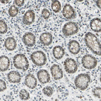 Immunohistochemical staining of human small intestine shows weak to moderate nuclear positivity in glandular cells.