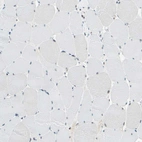 Immunohistochemical staining of human skeletal muscle shows no positivity in striated muscle fibers as expected.