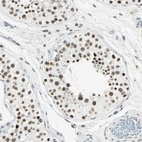 Immunohistochemical staining of human testis shows moderate to strong nuclear positivity in cells in seminiferous ducts.