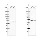 Western blot analysis using Anti-NELFE antibody HPA007187 (A) shows similar pattern to independent antibody HPA046502 (B).