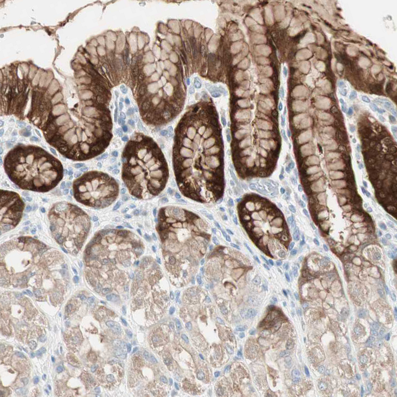 Anti-SULT1C2 Antibody