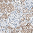 Immunohistochemical staining of human kidney shows moderate cytoplasmic positivity in cells in tubules.