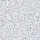 Immunohistochemical staining of human liver shows no positivity in hepatocytes as expected.
