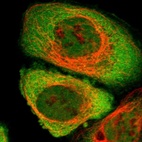 Immunofluorescent staining of human cell line A-431 shows localization to nucleoplasm & cytosol.