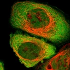 Immunofluorescent staining of human cell line A-431 shows localization to nucleoplasm & cytosol.