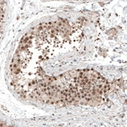 Anti-ALKBH5 Antibody