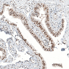 Immunohistochemical staining of human fallopian tube shows moderate to strong nuclear positivity in glandular cells.