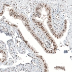 Immunohistochemical staining of human fallopian tube shows moderate to strong nuclear positivity in glandular cells.