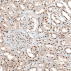 Immunohistochemical staining of human kidney shows nuclear positivity.