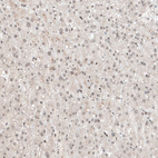 Immunohistochemical staining of human liver shows weak to moderate nuclear positivity in hepatocytes.