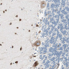 Anti-P4HTM Antibody