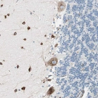 Immunohistochemical staining of human cerebellum shows strong cytoplasmic/membranous granular positivity in Purkinje cells and molecular layer cells.