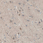 Immunohistochemical staining of human cerebral cortex shows moderate cytoplasmic positivity in neuronal cells.