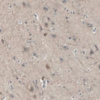 Immunohistochemical staining of human cerebral cortex shows moderate cytoplasmic positivity in neuronal cells.