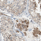 Immunohistochemical staining of human testis shows strong cytoplasmic positivity in Leydig cells.