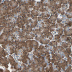 Immunohistochemical staining of human pancreas shows strong cytoplasmic positivity in exocrine glandular cells.
