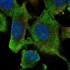 Anti-HECW1 Antibody