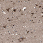 Immunohistochemical staining of human cerebral cortex shows strong nuclear/cytoplasmic positivity in neurons.
