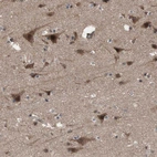 Immunohistochemical staining of human cerebral cortex shows strong nuclear/cytoplasmic positivity in neurons.